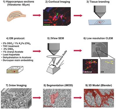 Three-Dimensional Nanostructure of an Intact Microglia Cell